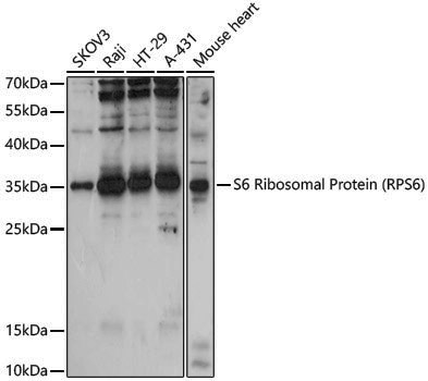 Anti-RPS6 Rabbit pAb
