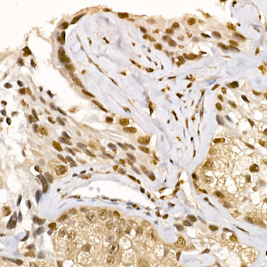 Anti-AKT1 Rabbit pAb