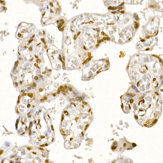 Anti-AKT1 Rabbit pAb