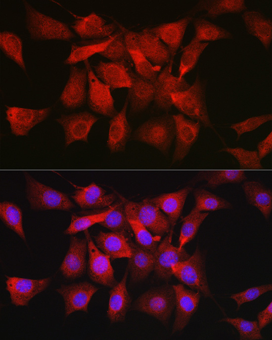 Anti-AKT1 Rabbit pAb
