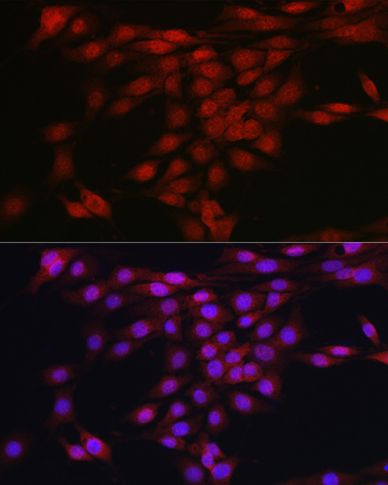 Anti-AKT1 Rabbit pAb