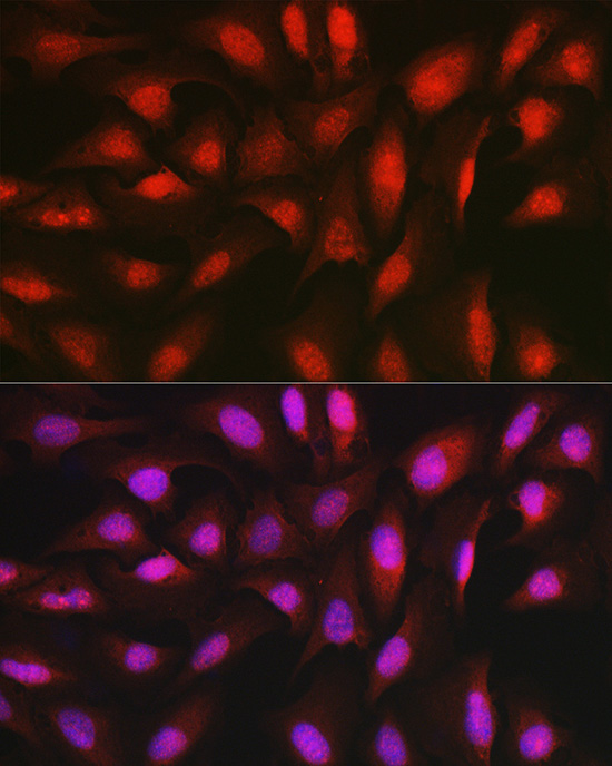 Anti-AKT1 Rabbit pAb