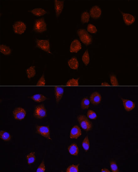Anti-AKT1 Rabbit pAb