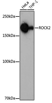 Anti-ROCK2 Rabbit pAb