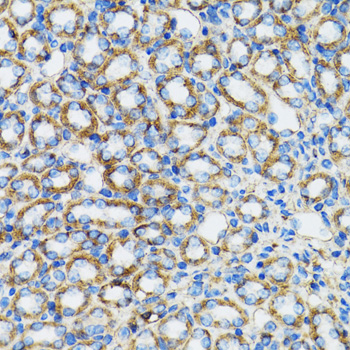 [KO Validated] Anti-CTNNA1 Rabbit pAb