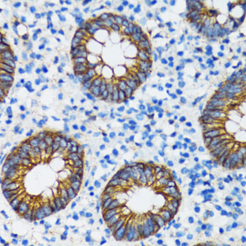 [KO Validated] Anti-CTNNA1 Rabbit pAb