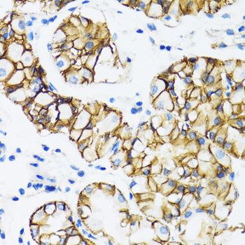 [KO Validated] Anti-CTNNA1 Rabbit pAb