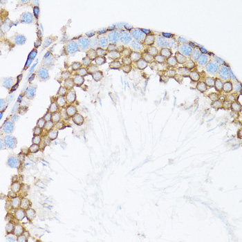 [KO Validated] Anti-CTNNA1 Rabbit pAb