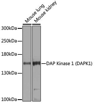 Anti-DAP Kinase 1 Rabbit pAb