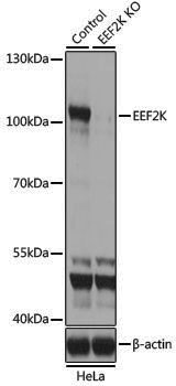[KO Validated] Anti-EEF2K Rabbit pAb