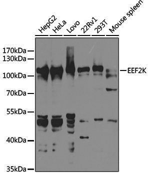 [KO Validated] Anti-EEF2K Rabbit pAb