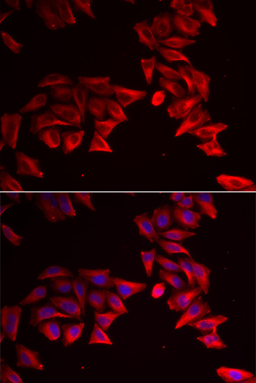 Anti-SFRP4 Rabbit pAb