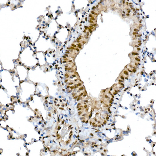 Anti-SNAI1 Rabbit pAb