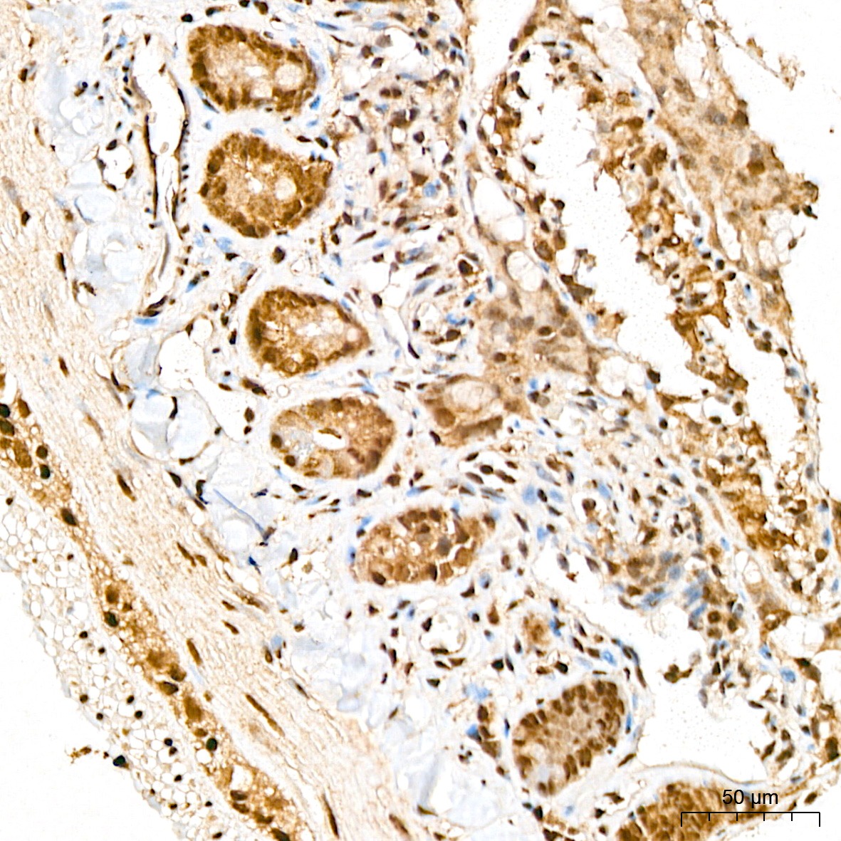 Anti-SNAI1 Rabbit pAb