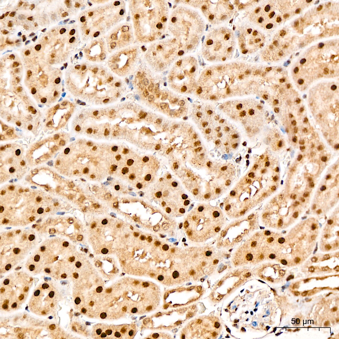 Anti-SNAI1 Rabbit pAb