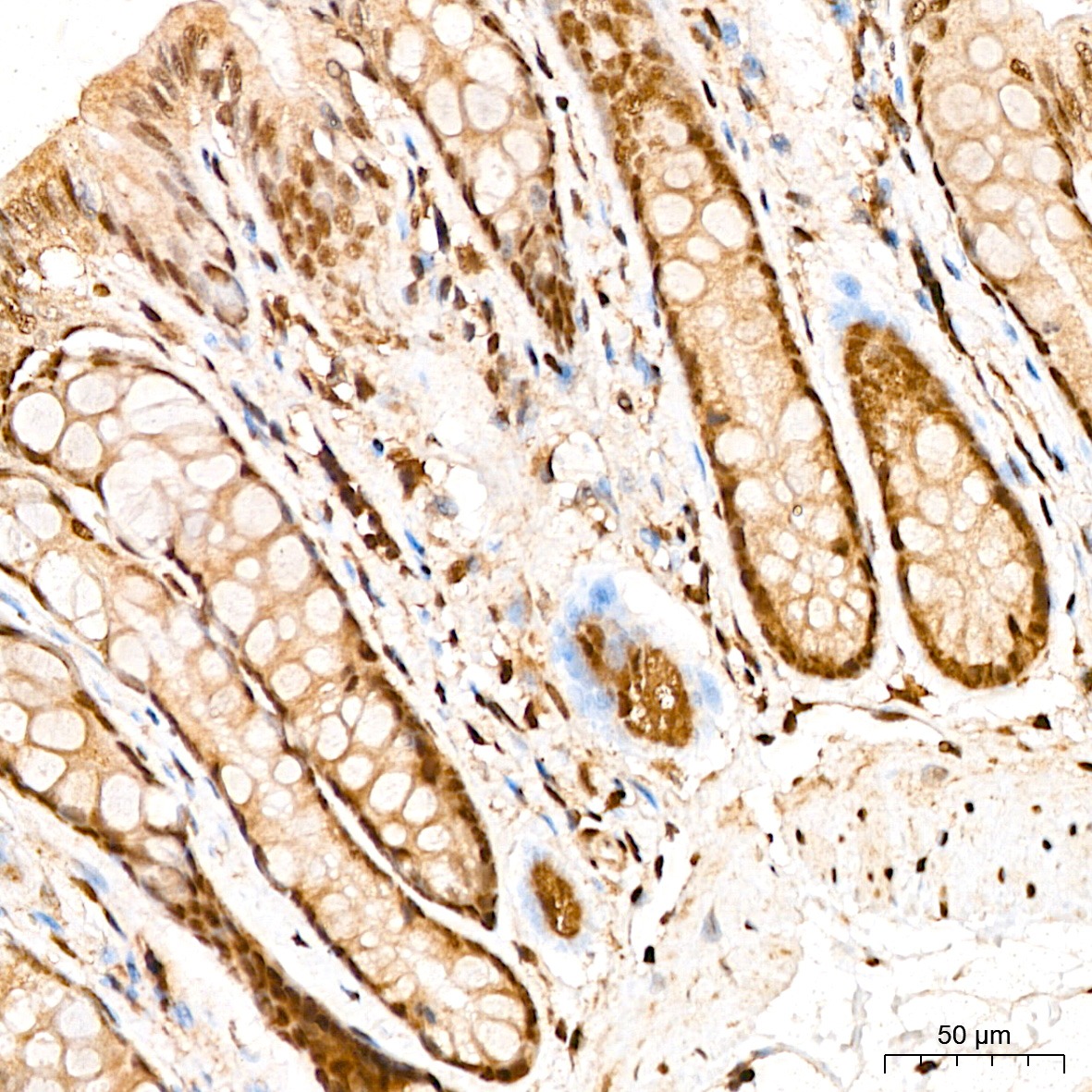 Anti-SNAI1 Rabbit pAb