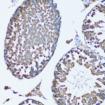 Anti-FDFT1 Rabbit pAb
