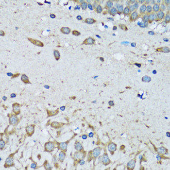 Anti-FDFT1 Rabbit pAb