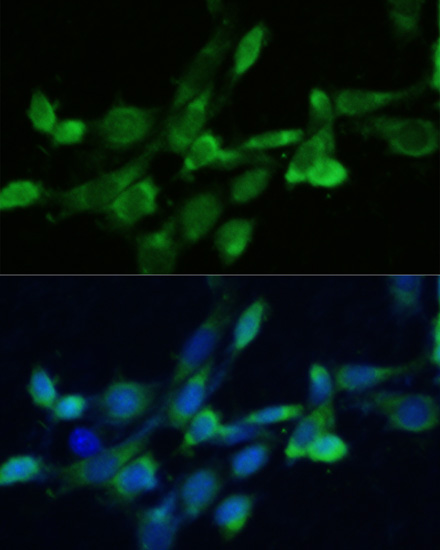 Anti-FDFT1 Rabbit pAb