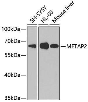 Anti-Methionine Aminopeptidase 2 Rabbit pAb