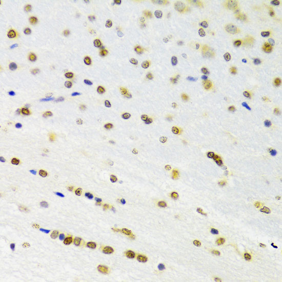 Anti-DOK1 Rabbit pAb