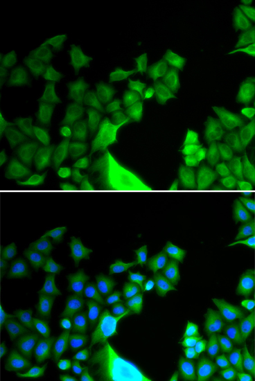 Anti-BCL2 L14 Rabbit pAb