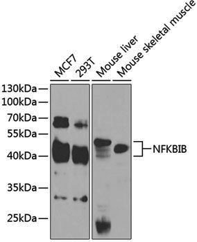 Anti-IKB beta Rabbit pAb