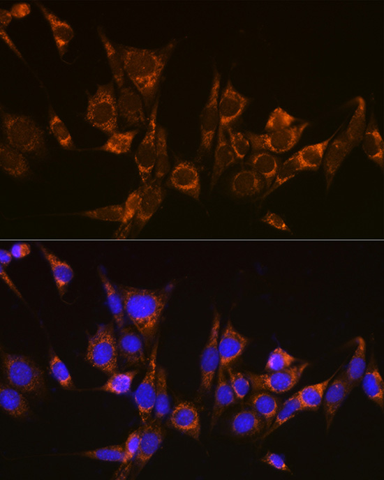 Anti-ATG3 Rabbit pAb