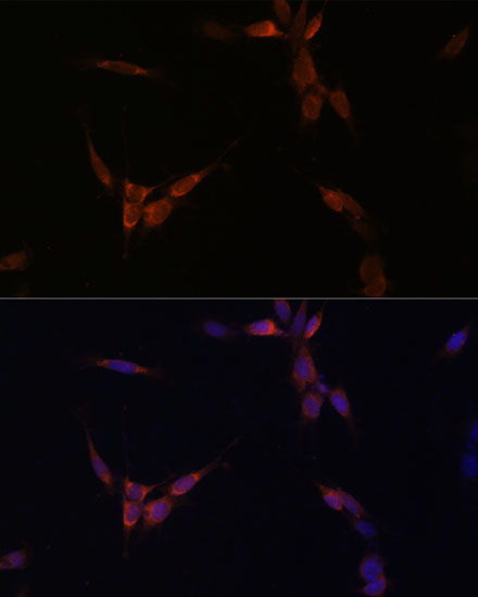 Anti-PP2A alpha Rabbit pAb