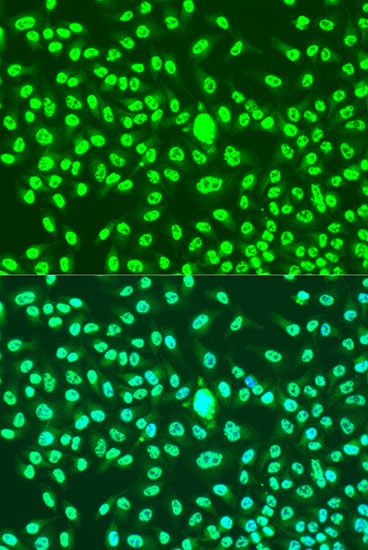 Anti-Cyclin A2 Rabbit pAb