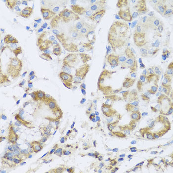 Anti-AMPK gamma 1 Rabbit pAb