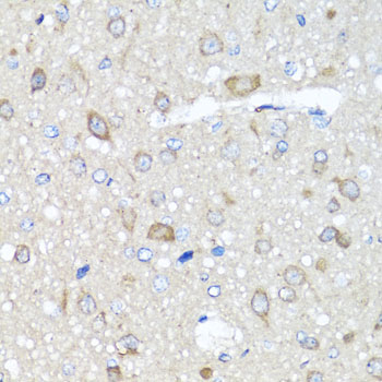 Anti-AMPK gamma 1 Rabbit pAb