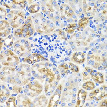 Anti-AMPK gamma 1 Rabbit pAb