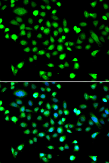 Anti-AMPK gamma 1 Rabbit pAb
