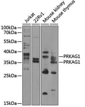 Anti-AMPK gamma 1 Rabbit pAb