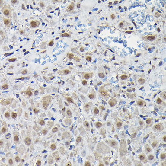 Anti-PFKFB3 Rabbit pAb