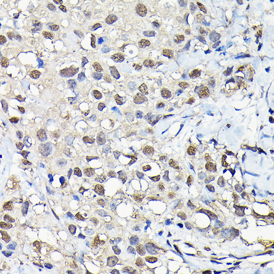 Anti-PFKFB3 Rabbit pAb