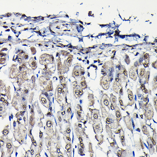 Anti-PFKFB3 Rabbit pAb