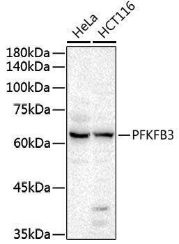 Anti-PFKFB3 Rabbit pAb
