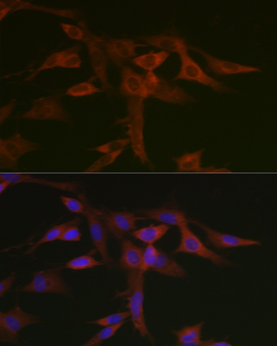 Anti-STAT5a Rabbit pAb