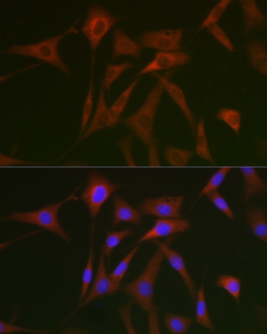 Anti-STAT5a Rabbit pAb