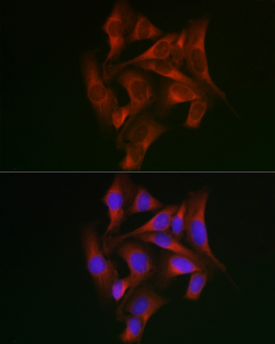 Anti-STAT5a Rabbit pAb