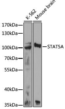 Anti-STAT5a Rabbit pAb