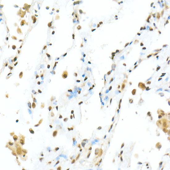 Anti-TEF1/TEAD-1 Rabbit pAb