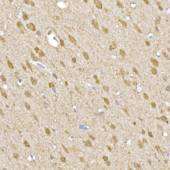 Anti-SOCS1 Rabbit pAb