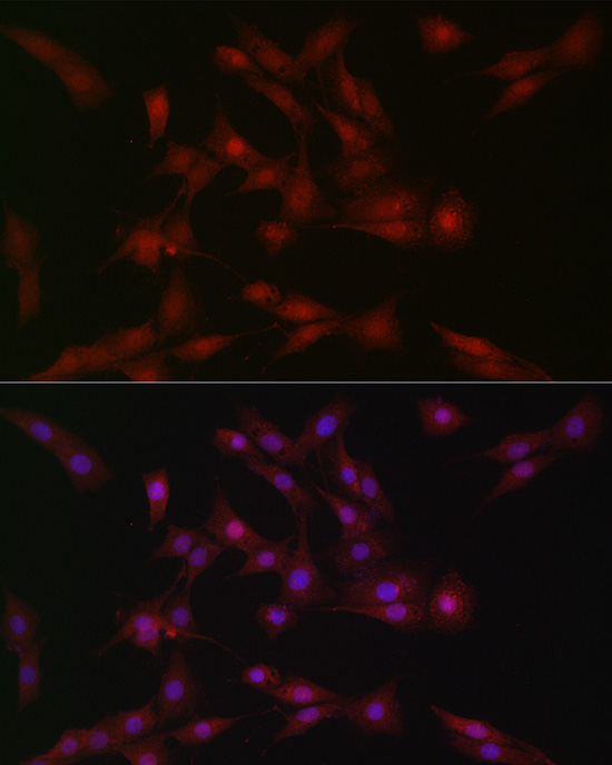 Anti-SOCS1 Rabbit pAb