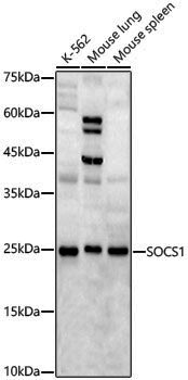 Anti-SOCS1 Rabbit pAb