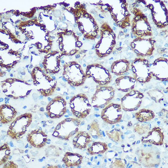Anti-Complex III Subunit 5 Rabbit pAb