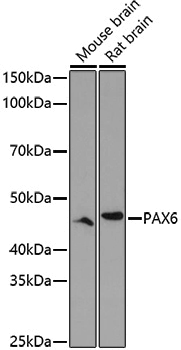 Anti-PAX6 Rabbit pAb