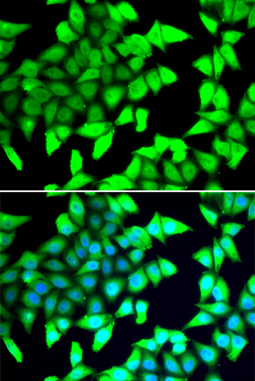 Anti-HDAC5 Rabbit pAb